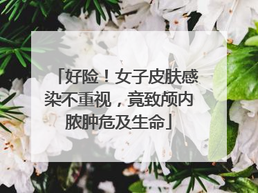 好险！女子皮肤感染不重视，竟致颅内脓肿危及生命