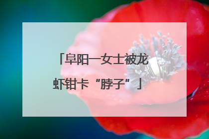 阜阳一女士被龙虾钳卡“脖子”